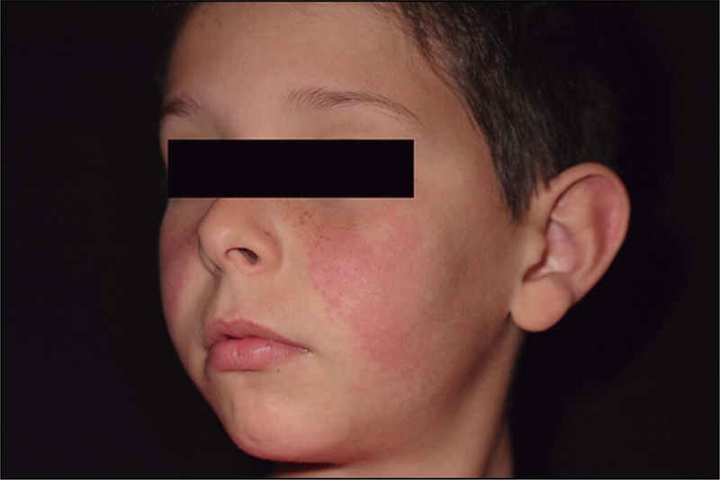 Nhiễm Parvovirus khi mang thai có ảnh hưởng đến thai nhi không? 2