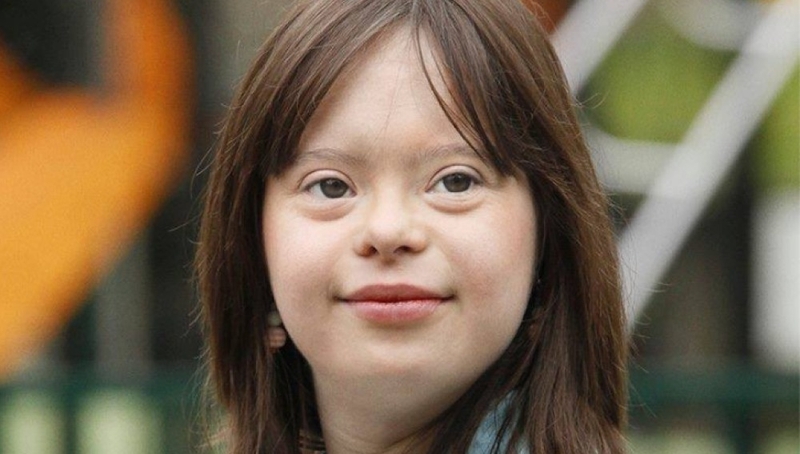 Nhiễm sắc thể tương đồng: Cấu tạo, vai trò và những điều nên biết! 3