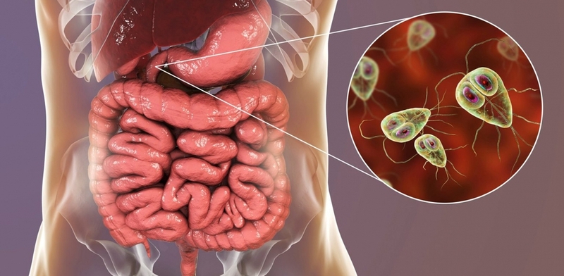 Nhiễm trùng đường ruột do virus: Chẩn đoán và điều trị