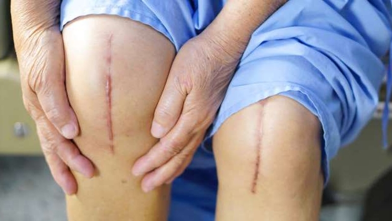 Nhiễm trùng khớp giả: Nguyên nhân, triệu chứng và cách điều trị 2