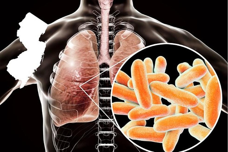 Nhiễm trùng Legionella và viêm phổi do Legionella có nguy hiểm không? 2