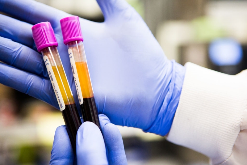 Nhiễm trùng máu do virus: Nguyên nhân, triệu chứng và mức độ nguy hiểm 3