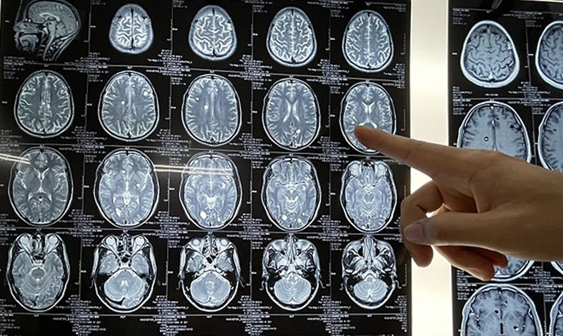 nhiem-trung-nao-do-giun-san-co-nguy-hiem-khong 3.jpg