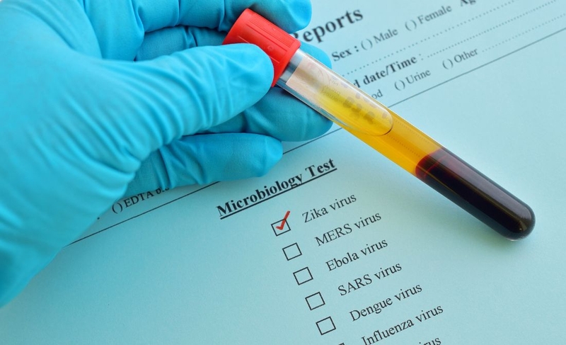 Nhiễm trùng nhiệt đới: Nguyên nhân và cách phòng ngừa hiệu quả 3