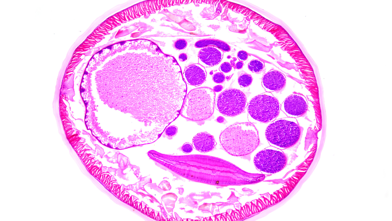 Nhiễm trùng roi Trichomonas có nguy hiểm không?