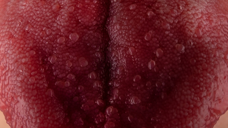 Virus HPV có thể gây ra ung thư lưỡi