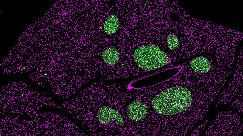 Nhịn ăn gián đoạn ảnh hưởng đến chức năng tế bào β và nguy cơ mắc bệnh tiểu đường 2