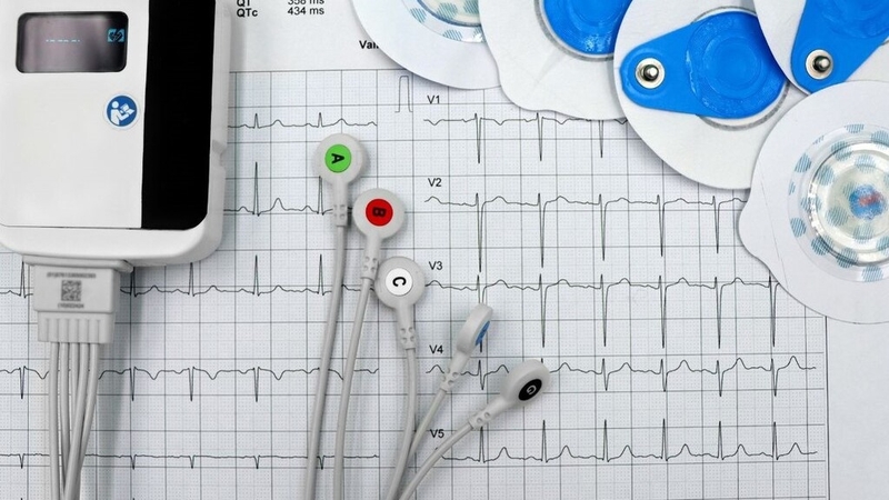 Nhịp nhanh QRS hẹp: Nguyên nhân, triệu chứng và cách điều trị hiệu quả 3