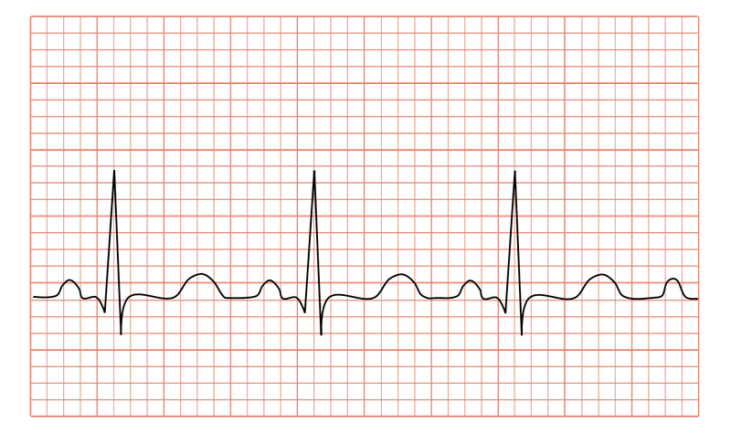 nhip-nhanh-xoang-co-chua-khoi-duoc-hay-khong 1.png