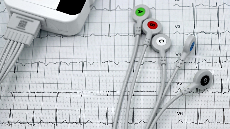Nhịp tim chậm có thể xuất hiện dưới nhiều dạng khác nhau
