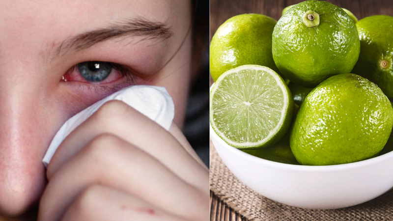 Nhỏ chanh vào mắt: Hậu quả khó lường cho đôi mắt! 2