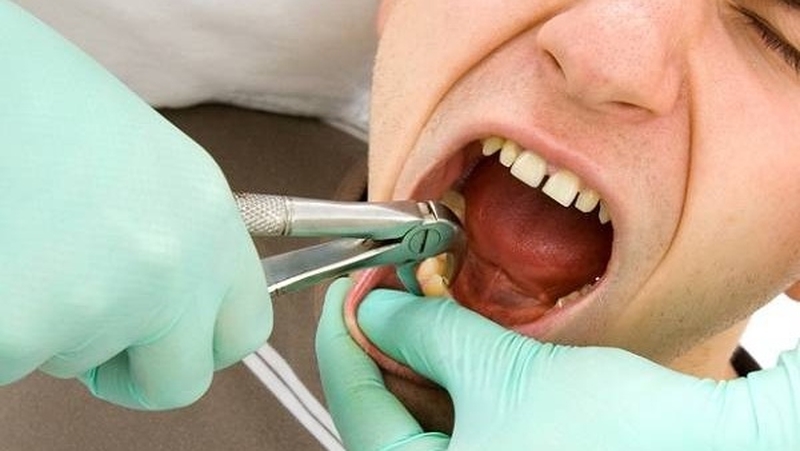 nho-rang-khon-bao-lau-het-dau-cach-giam-dau-sau-nho-rang-khon-2