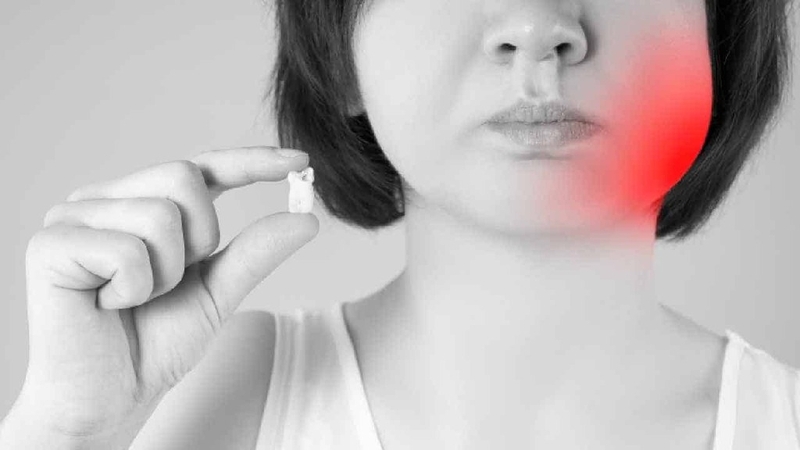 Nhổ răng khôn có nguy hiểm không? Biện pháp phòng ngừa biến chứng sau nhổ răng khôn 2