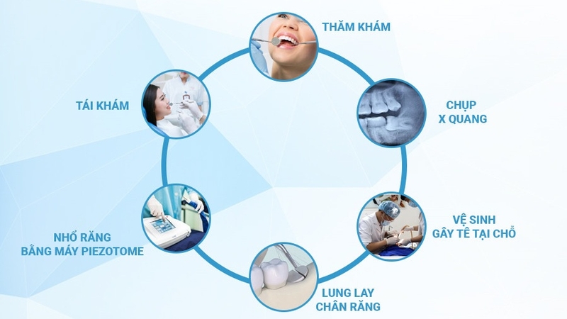 nhổ răng khôn công nghệ piezotome 02