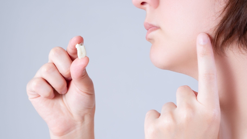 Nhổ răng khôn kiêng ăn gì?