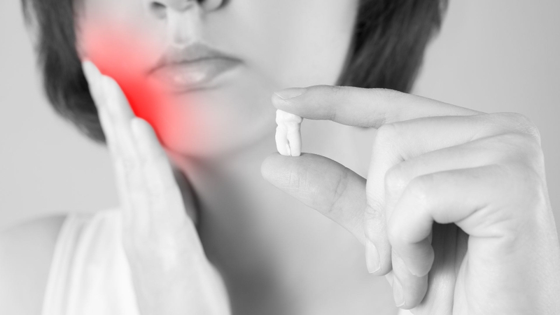 Nhổ răng lộ xương hàm do đâu? Những biến chứng có thể gặp phải khi nhổ răng 2