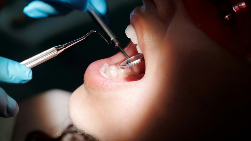 nho-rang-sau-nhung-dieu-can-biet-ve-sau-rang 4