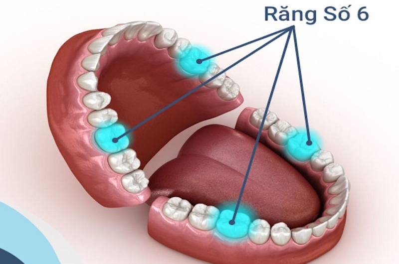 Tìm hiểu chi tiết về chỉ định nhổ răng số 6 hàm dưới 1