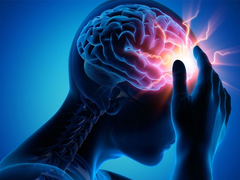 Nhồi máu não là gì? Các đặc điểm trên CT nhồi máu não không phải ai cũng biết 1