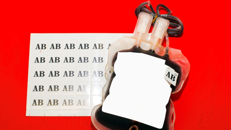 Nhóm máu AB là gì? Nhóm máu AB truyền được cho nhóm máu nào? 2