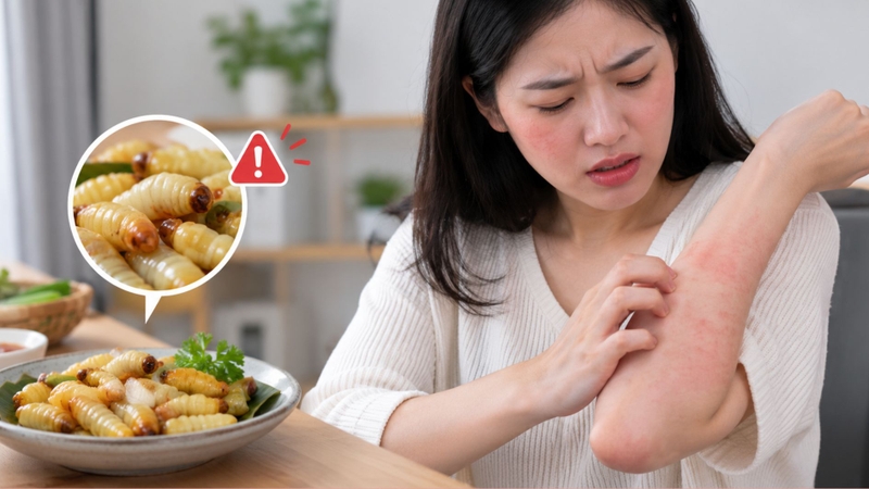 Người từng dị ứng sau khi ăn nhộng ong cần thận trọng
