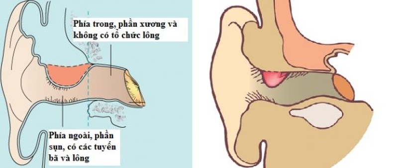 Nhọt ống tai là gì? Cách nhận biết và điều trị hiệu quả 1