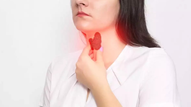 Nhu mô tuyến giáp không đều cảnh báo bệnh gì? 1