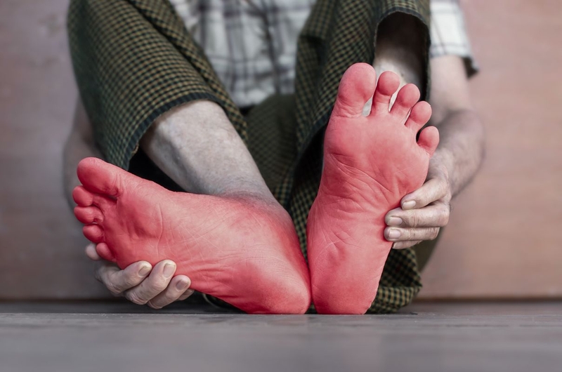 Tìm hiểu về chứng nhức chân và những vấn đề sức khỏe tiềm ẩn 2