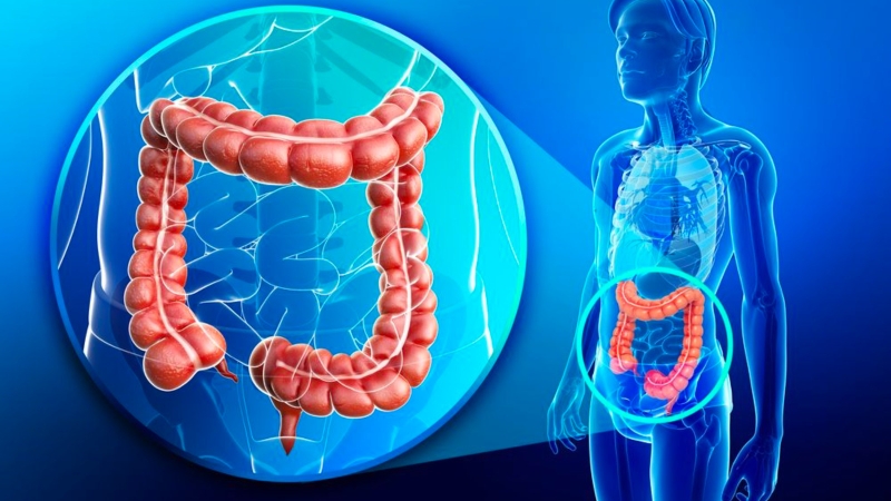 Những ai có nguy cơ mắc viêm đại tràng? 1