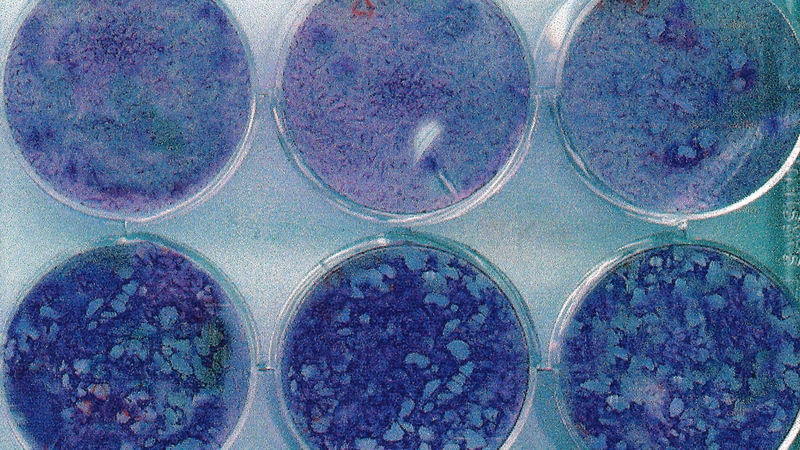 Virus varicella zoster có khả năng gây viêm não và biến chứng thần kinh