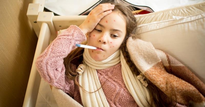 Những biểu hiện giúp bạn nhận biết đã đến thủy đậu giai đoạn cuối 1