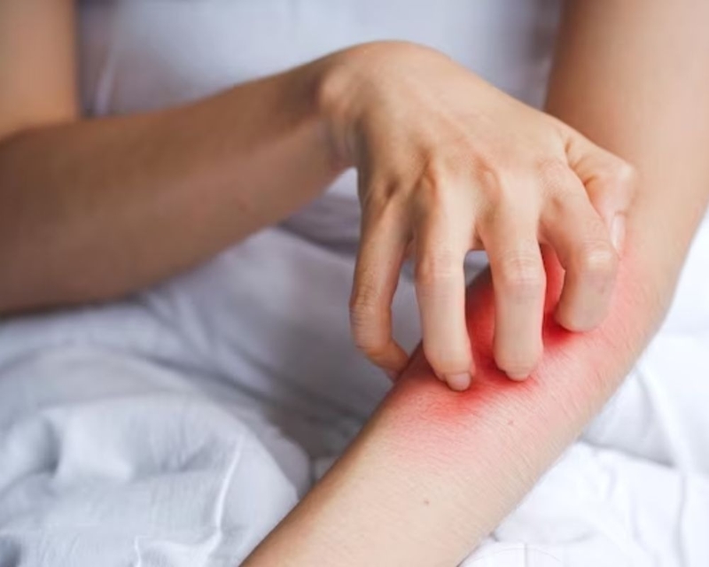 nhung-cach-duoi-kien-ra-khoi-nha-an-toan-va-khong-ton-kem 2.jpg