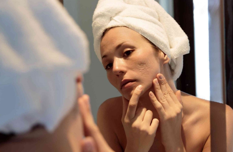 Những cách giúp ngăn ngừa thâm, sẹo sau phẫu thuật 2