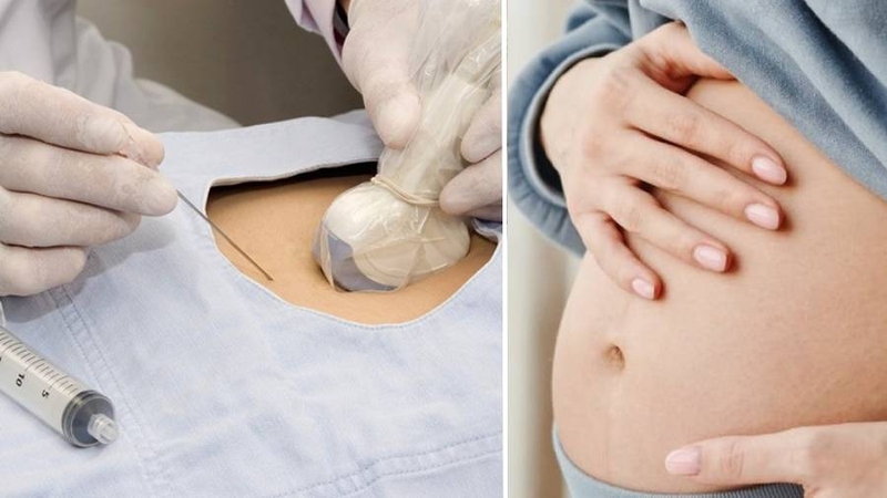 Tiêm dịch ối trực tiếp chỉ áp dụng khi thai kỳ có nguy cơ cao và cần can thiệp khẩn cấp