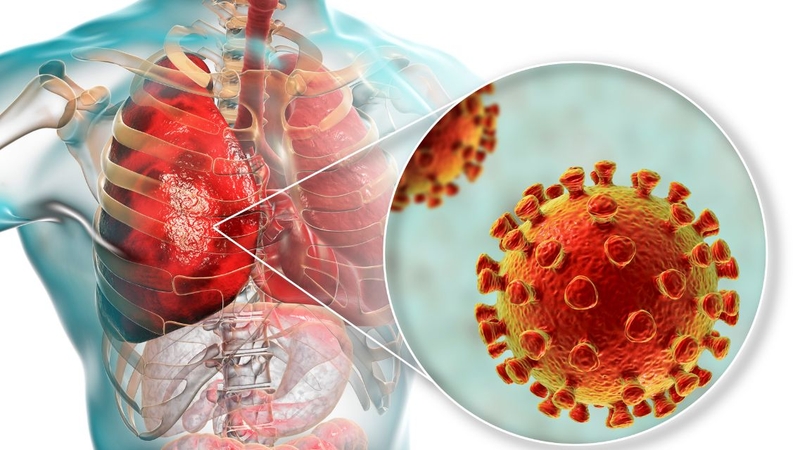 Những câu hỏi về bệnh viêm phổi​ thường gặp và giải đáp chi tiết 3