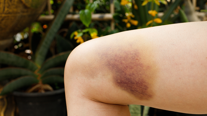 Những dấu hiệu bệnh gan nguy hiểm cần nhận biết ngay2