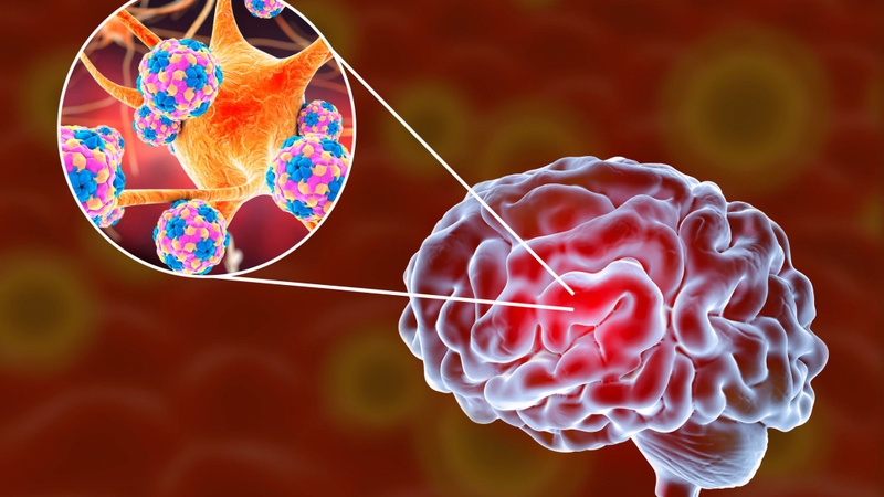 Virus quai bị có khả năng xâm nhập hệ thần kinh trung ương
