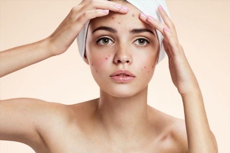 Những dấu hiệu cho thấy cơ thể đang dư thừa đường 2