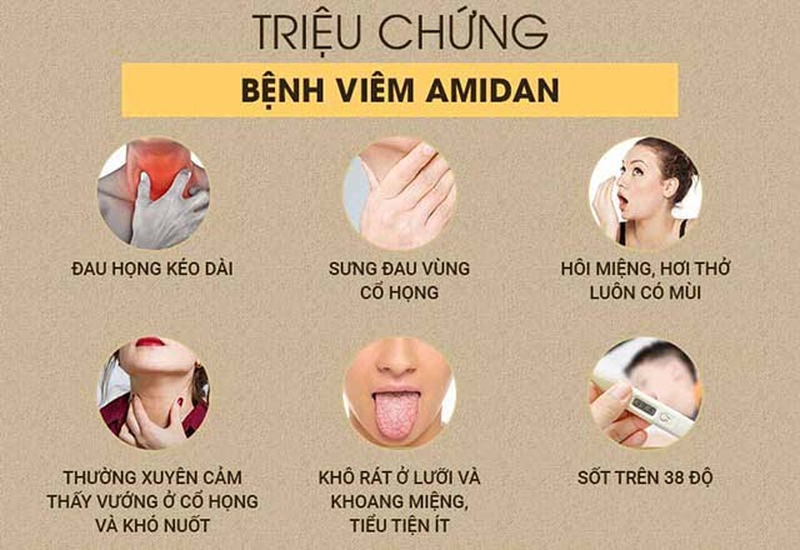 Những dấu hiệu của bệnh viêm amidan và cách chăm sóc hiệu quả