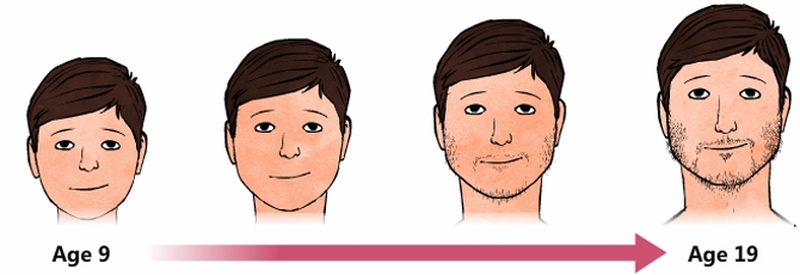 Những dấu hiệu của dậy thì và thời gian dậy thì đúng chuẩn ở trẻ