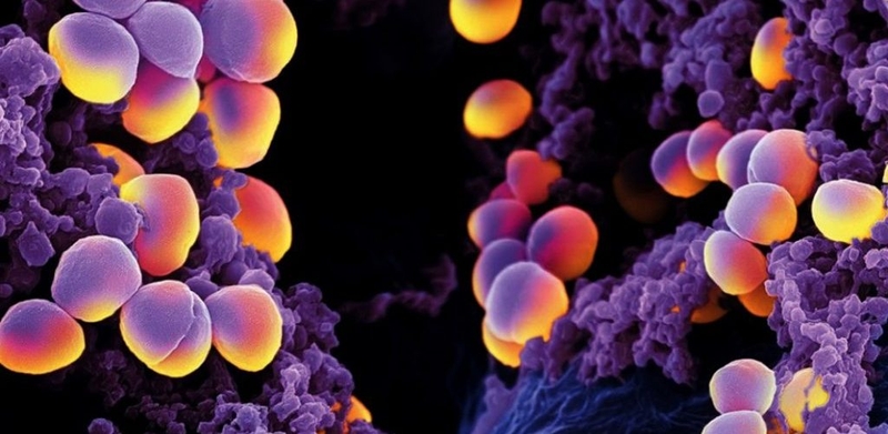 nhung-dau-hieu-la-bao-hieu-benh-choc-lo