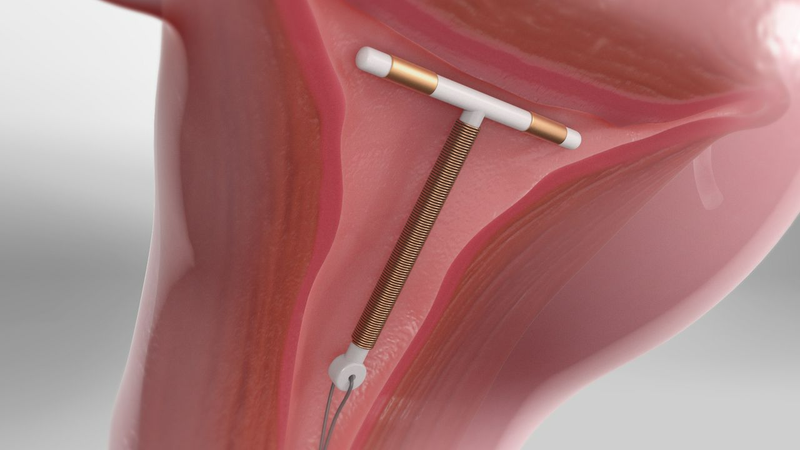 Những dấu hiệu lệch vòng tránh thai chị em phụ nữ nên biết2