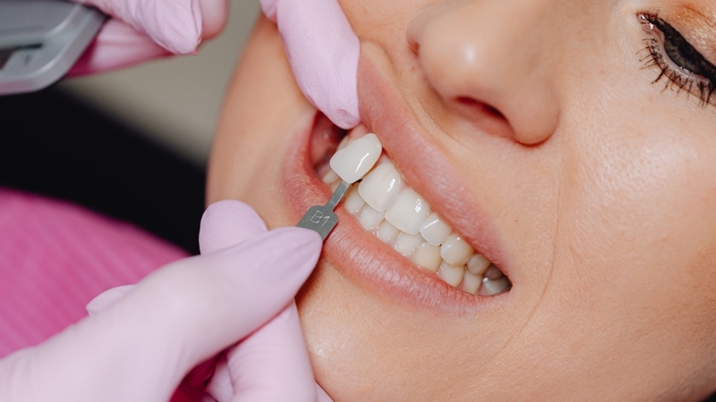 Răng sứ bị hở cần được nha sĩ kiểm tra để gắn lại hoặc làm mới mão sứ phù hợp