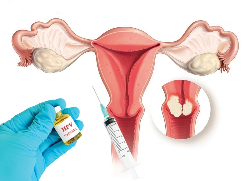Những địa chỉ tiêm HPV ở Tây Ninh tin cậy, chất lượng
