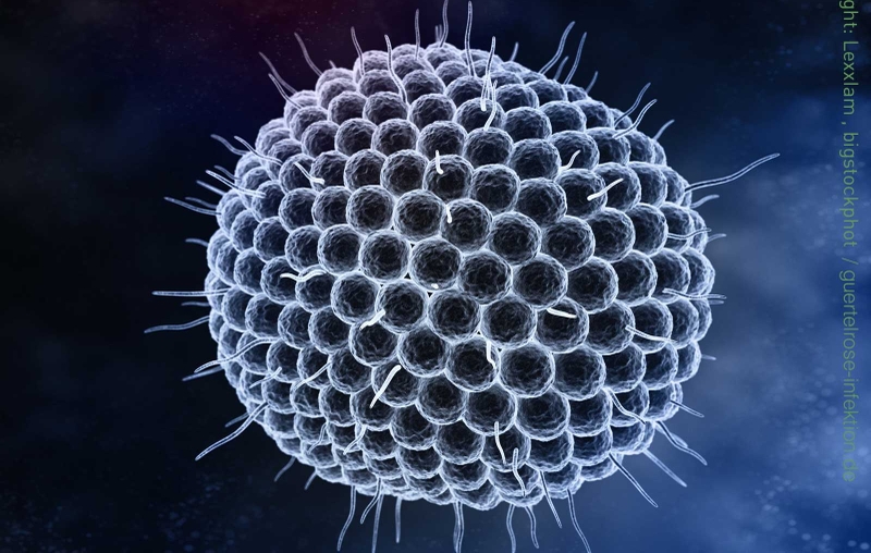 Những điểm giống và khác nhau giữa zona thần kinh và thủy đậu-1