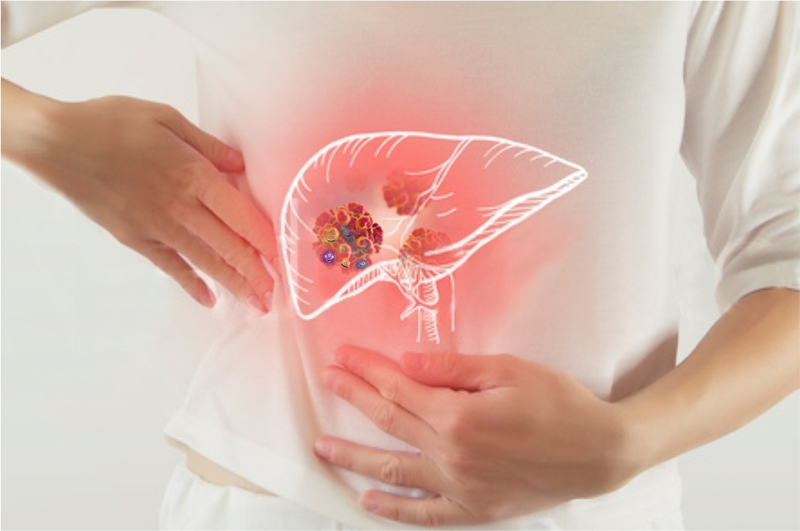 Những điều bạn cần biết về bệnh viêm gan siêu vi 1