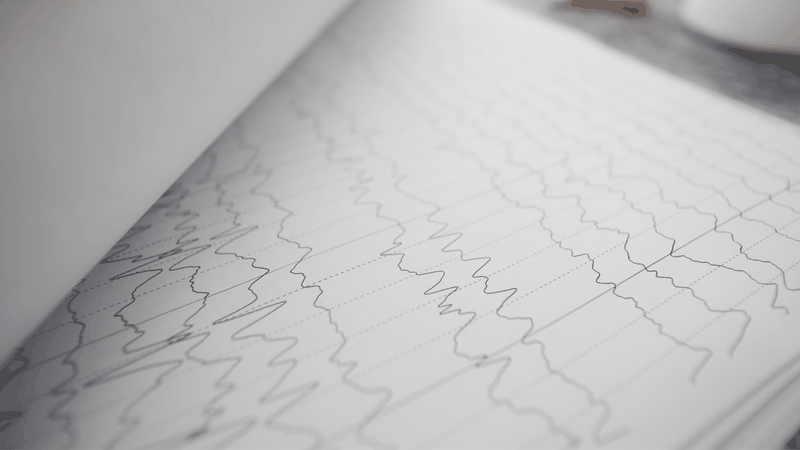 Có 4 loại sóng chính trong điện não đồ, tương ứng với các trạng thái hoạt động khác nhau của não bộ