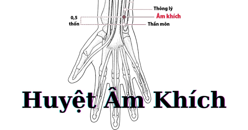 nhung-dieu-ban-can-biet-ve-huyet-am-khich 1.png