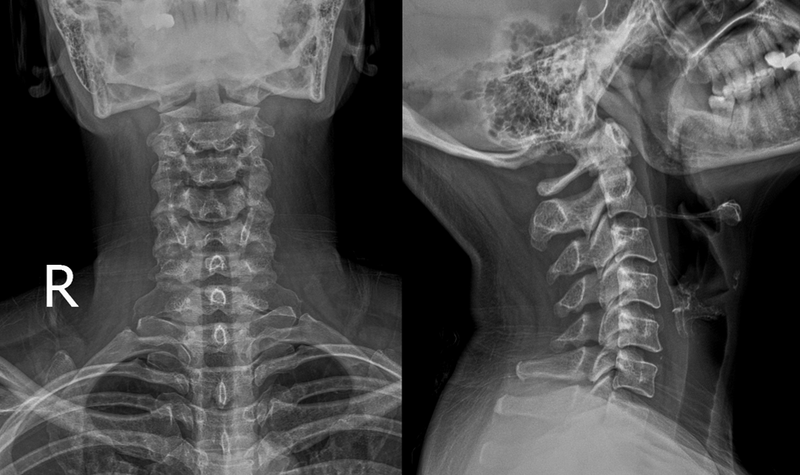 Những điều bạn cần biết về tia xạ trong y khoa