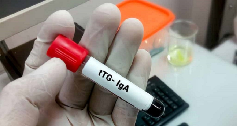 Những điều bạn cần biết về tTG là gì? Ý nghĩa của tTG trong xét nghiệm bệnh Coeliac 4